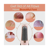 Electric Pedicure Foot File – Rechargeable Electric Foot Callus Remover